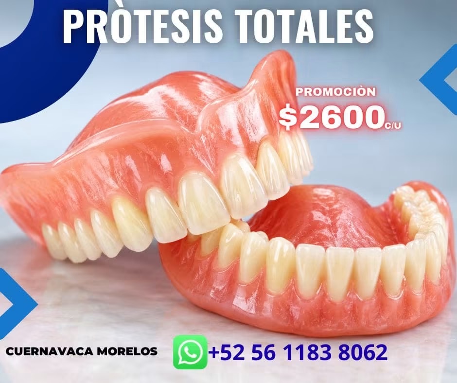 Prótesis dentales totales